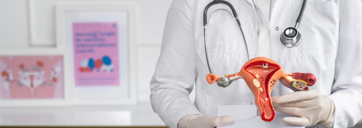 PCOS and Hirsutism: Unveiling the Challenges and Solutions